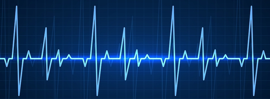 bigstock-ekg-blue-sinusoidal-pulse-lin-352304804